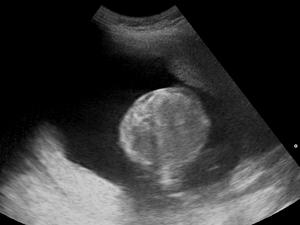 Ultrasound Scan ND 145330 1455290 cr.png