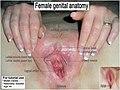 Female vaginal anatomy.jpg