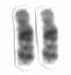 Human male karyotpe high resolution - Chromosome 18 cropped.png