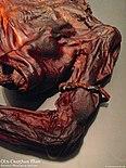 dead man's arm