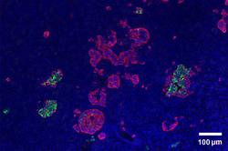 PP cells in Pancreatic Islet.png