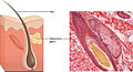 407 Sebaceous Glands.jpg