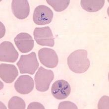 Babesia microti CDC.jpg