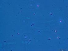 Geobacter sulfurreducens.TIF