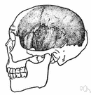 temporal muscle - muscle extending from the temporal fossa to the coronoid process of the mandible