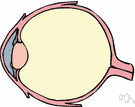 anterior synechia - adhesion between the iris and the cornea