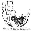 metrorrhagia - bleeding from the uterus that is not due to menstruation