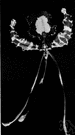 butterfly orchid - any orchid of the genus Psychopsis: spectacular large tiger-striped orchids