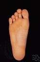 great toe - the first largest innermost toe