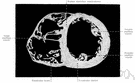 diastole - the widening of the chambers of the heart between two contractions when the chambers fill with blood