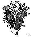 right atrium - the right upper chamber of the heart that receives blood from the venae cavae and coronary sinus