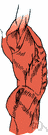 abdominal actinomycosis - a serious form of actinomycosis that affects the abdomen