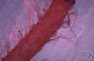 vena vesicalis