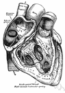 right ventricle - the chamber on the right side of the heart that receives venous blood from the right atrium and pumps it into the pulmonary trunk