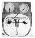 mittelschmerz - pain in the area of the ovary that is felt at the time of ovulation (usually midway through the menstrual cycle)