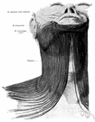 platysma - either of two broad muscles located on either side of the neck and innervated by the facial nerve