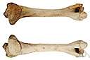 metaphysis - the growing part of a long bone between the diaphysis and the epiphysis