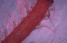 uterine vein