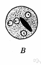 Endamoeba histolytica - the parasitic ameba that causes amebic dysentery in human beings