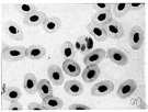 blood corpuscle - either of two types of cells (erythrocytes and leukocytes) and sometimes including platelets