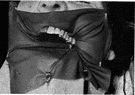 dental surgery - the branch of dentistry involving surgical procedures