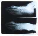 astragalar - of or relating to the anklebone