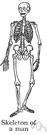 marble bones disease - an inherited disorder characterized by an increase in bone density