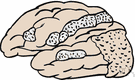 brain disease - any disorder or disease of the brain