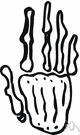 metacarpal bone - any bone of the hand between the wrist and fingers