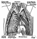 pleura - the thin serous membrane around the lungs and inner walls of the chest