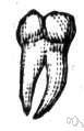 adult tooth - any of the 32 teeth that replace the deciduous teeth of early childhood and (with luck) can last until old age