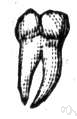 permanent tooth - any of the 32 teeth that replace the deciduous teeth of early childhood and (with luck) can last until old age