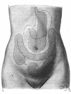 transverse colon - the part of the large intestine that extends across the abdominal cavity and joins the ascending to the descending colon