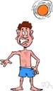 actinic dermatitis - dermatitis caused exposure to sunlight