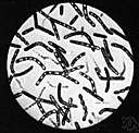 Bacteroidaceae - family of bacteria living usually in the alimentary canal or on mucous surfaces of warm-blooded animals