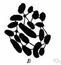 trisomy - chrosomal abnormality in which there is one more than the normal number of chromosomes in a cell