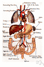 venous thrombosis - thrombosis of a vein without prior inflammation of the vein