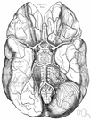 anterior vertebral vein - a vein that accompanies the ascending cervical artery and opens into the vertebral vein