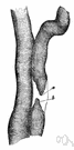 sarcolemma - an extensible membrane enclosing the contractile substance of a muscle fiber