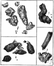 BM - solid excretory product evacuated from the bowels