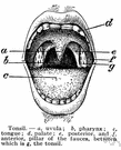palatine tonsil - either of two masses of lymphatic tissue one on each side of the oral pharynx