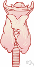 tracheitis - inflammation of the trachea
