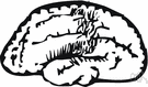 anarthria - partial or total loss of articulate speech resulting from lesions of the central nervous system