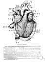 athlete's heart - enlarged heart commonly found among athletes trained for endurance