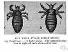 pediculosis capitis - infestation of the scalp with lice