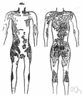 skin disease - a disease affecting the skin