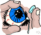 contact lens - a thin curved glass or plastic lens designed to fit over the cornea in order to correct vision or to deliver medication