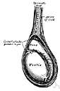 undescended testis - a testis that fails to move into the scrotum as the male fetus develops