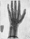 fluoroscope - an X-ray machine that combines an X-ray source and a fluorescent screen to enable direct observation