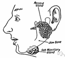 gland disease - a disorder of the glands of the body